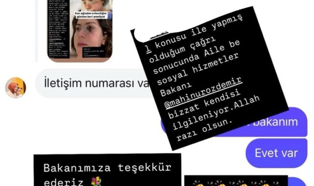 Bakan Göktaş'tan, şiddet mağduru kadına destek