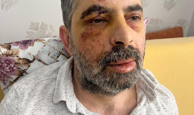 Köpeklerden kaçarken bisikletten düşüp, yaralandı