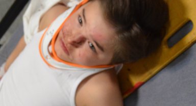 Kazada yaralanan anne ve oğlunu taşıyan ambulans, otomobille çarpıştı
