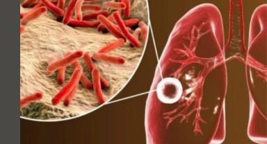 Karaman İl Sağlık Müdürü Verem Haftasında Önemli Açıklamalar Yaptı